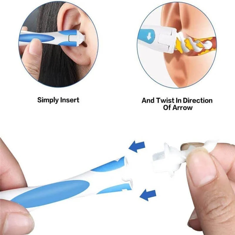 Ear Cleaner Ear Wax Removal